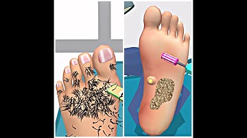 Very satisfying and relaxing ASMR | Foot Clinic #mobilegames #asmr #gameplay