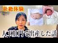 【壮絶】人工肛門で出産したときの話