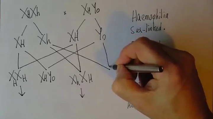 Genetics 7, Sex linked inheritance and haemophilia