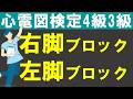 右脚ブロック、左脚ブロック【チャレンジ心電図検定4級3級】