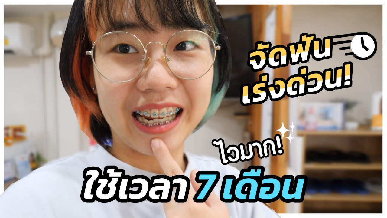 ไวมากก!! จัดฟันเร่งด่วน 7 เดือนนิดๆ เสร็จ! ทำไมมันเร็วขนาดนั้น? #รีวิวจัดฟัน </div><!--AfterDocument(1267337,1267324)--></article>
				
				<div class=