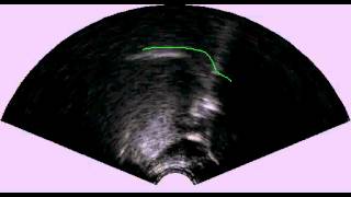 B voiced velar plosive