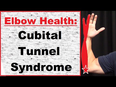 Cubital Tunnel Syndrome Everything You need to know 