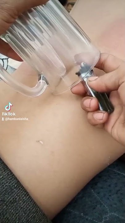 cara cepat mengusir angin dalam tubuh