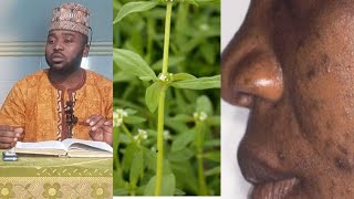 Maganin Kurajen Fuska Kesbi Sheikh Abbakar Pharmacy