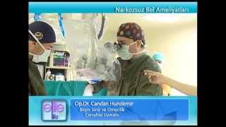 Narkozsuz Bel Fıtığı Ameliyatı Sonrası - Opr Dr Candan Hundemir