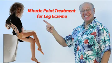 Miracle Point Treatment for Leg Eczema