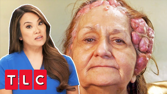 Dr. Pimple Popper -- Shocking Huge Cyst Looks Like 'Breast