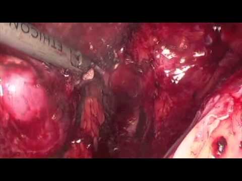 Vagina free