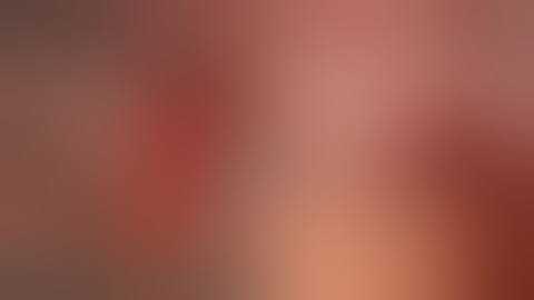 Full Arch Rehabilitation Using Digital System