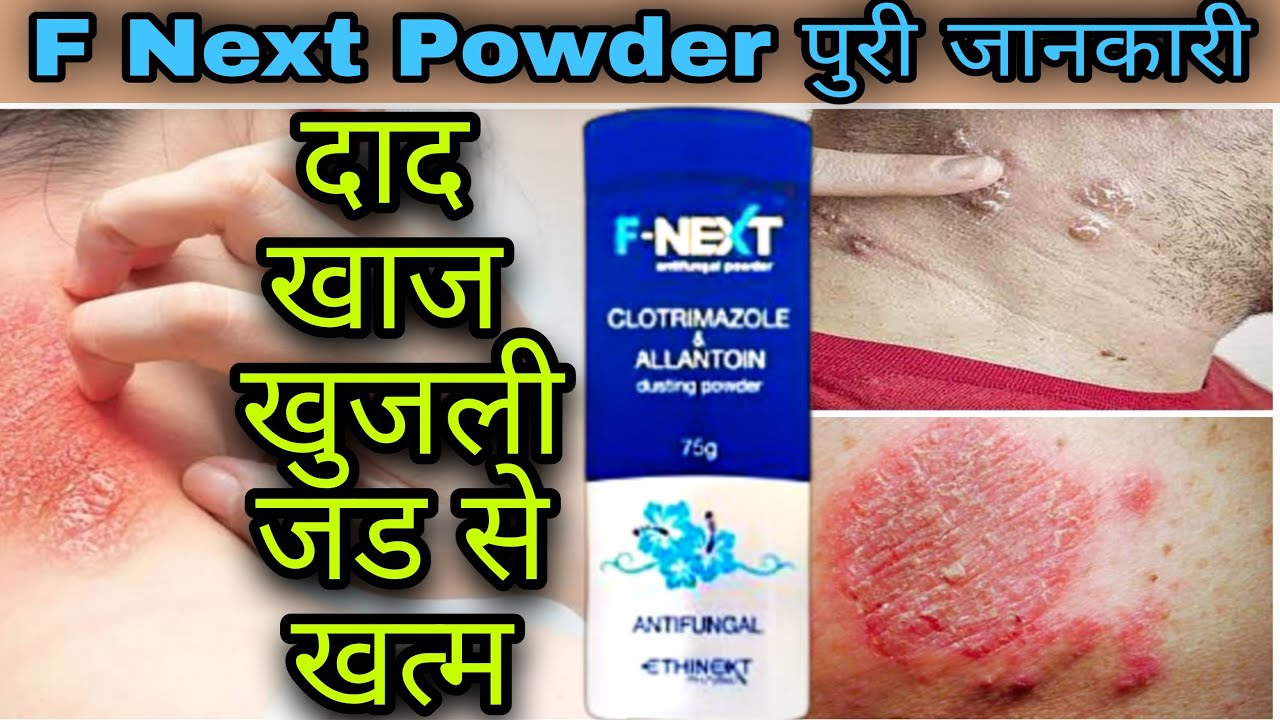 F Next Powder Review Clotrimazole & Allantoin Dusting Powder Uses