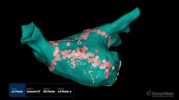 Value of Ripple Mapping
