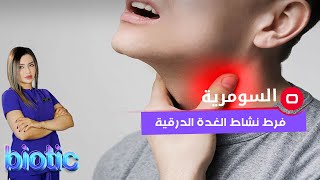 فرط نشاط الغدة الدرقية