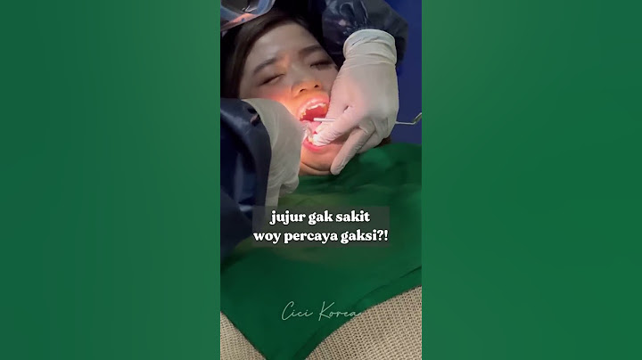 SPILL BIAYA CABUT GIGI🥳🥳 #shorts #shortvideo #cabutgigi #behelcici #behelstory #ngeshortsdulu