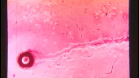 Dictyostelium Discoideum