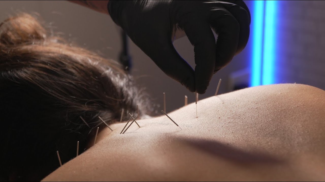 Dry Needling  |  No Talking  | ASMR