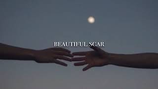 beautiful scar - Alicia Moffet (slowed down)