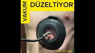 Vakumla Düzeltme Nasıl İşliyor?