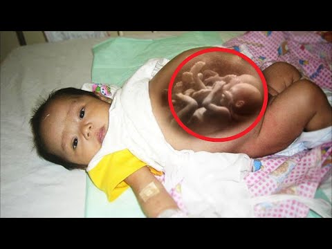Video: Ali fetusi kakajo v maternici?