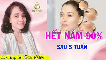 Hết 90% Nám Da sau 5 tuần - Nguyễn Ngọc Anh iNaDo
