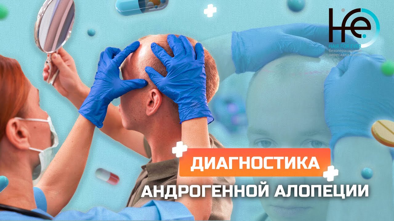 Диагностика волос при андрогенной алопеции - YouTube
