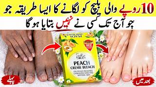 😱 How to Remove Tan from Hands & Feet at Home | Skin Polish & Pedicure Remedy | Tan Remover