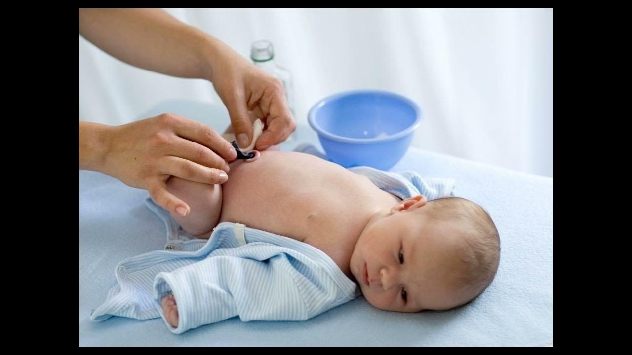 Как ухаживать за ранками. Обработка пупочной ранки новорожденного. Рекомендации по уходу за ребенком. Уход за новорожденным ребенком. Как ухаживать за ранками.