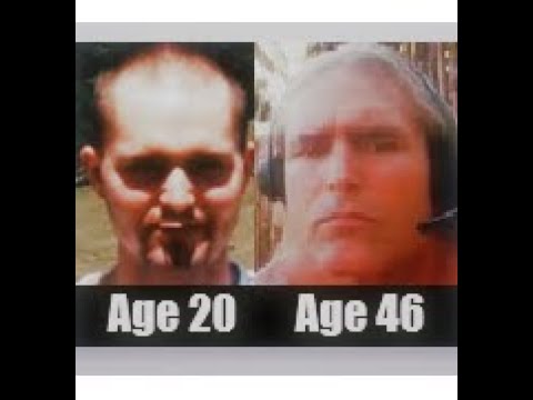 Facial Bone Development , Height Growth / An Authentic Discussion