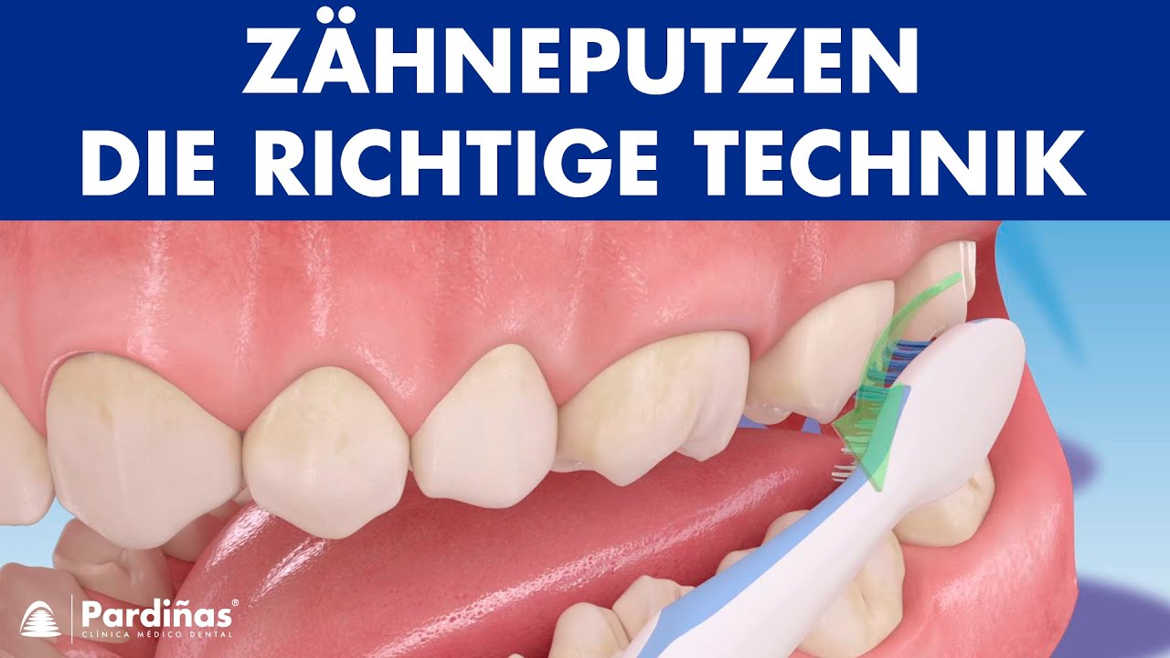 Wie gefährlich sind wurzelbehandelte Zähne? Biologische Zahnheilkunde Balingen