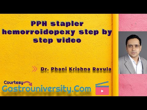 Rectum-PPH stapler hemorroidopexy step by step video