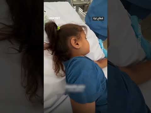 رصاصة لم تخترق الجمجمة: حالة طبية غريبة