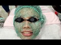 $25 IPL DARK SPOTS REMOVAL & Bright Face Treatment In Jakarta Indonesia 🇮🇩 4K (Epilepsy Trigger)