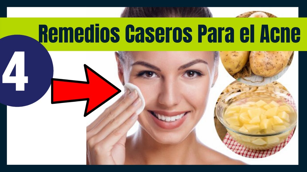 Remedios Caseros Para Adelgazar La Cara