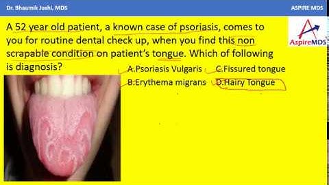 IMAGE BASED MCQ |ASPIRE MDS | Dr Bhaumik Joshi | NEET | AIIMS| MDS