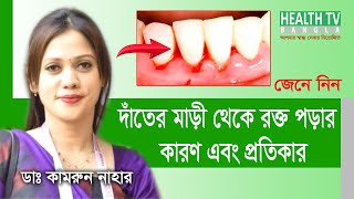 দাঁতের মাড়ি থেকে রক্ত পড়ার কারণ ও প্রতিকার | Causes and remedies for bleeding gums | Dr.Kamrun Nahar screenshot 3