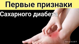 Признаки высокого сахара! Что делать в этом случае? 16 признаков высокого сахара!