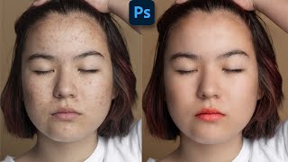 Skin Retouching in Photoshop  | Tutorial For Beginners