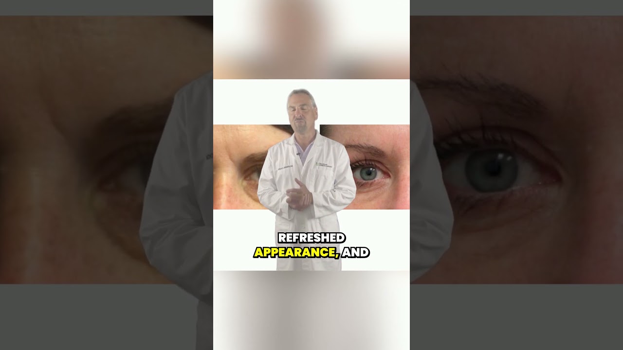 The Benefits of Eyelid Surgery