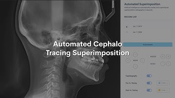 WebCeph: Automated Cephalo Tracing Superimposition