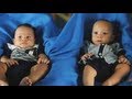 Twin Brothers Receive The Gift of Two Hearts