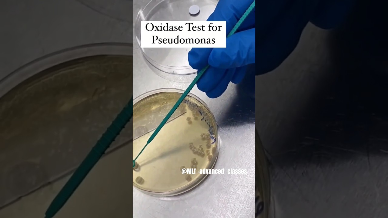OXIDASE TEST FOR PSUEDOMONAS || OXIDASE POSITIVE BACTERIA || 