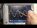 Linear Power Supplies and the Filter Capacitor