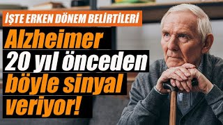 Alzheimerın Erken Dönem Belirtilerine Dikkat Alzheimer Başlangıcı Nasıl Anlaşılır?