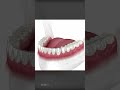 Comment les aligneurs invisalign fonctionnentils pour redresser les dents 