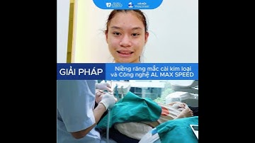 CHIÊM NGƯỠNG TOP 3 CA NIỀNG RĂNG THÀNH CÔNG TẠI NHA KHOA ATHENA TRONG THÁNG 11 NÀY~~~