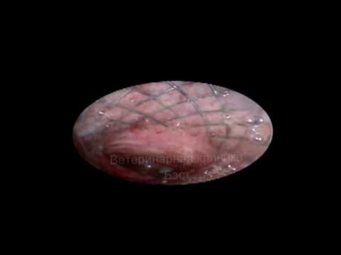 Коллапс трахеи 4-я степень (полное смыкание)