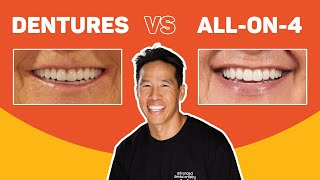 All-On-4 Dental Implants Treatment | An In Depth Look Case Study Dental Boutique