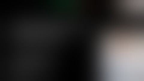 Laproscopic Donor Nephrectomy || Urology ||