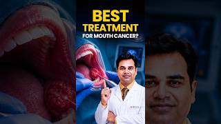 What's the BEST Treatment for Mouth Cancer? | Oral Cancer | Oncare
