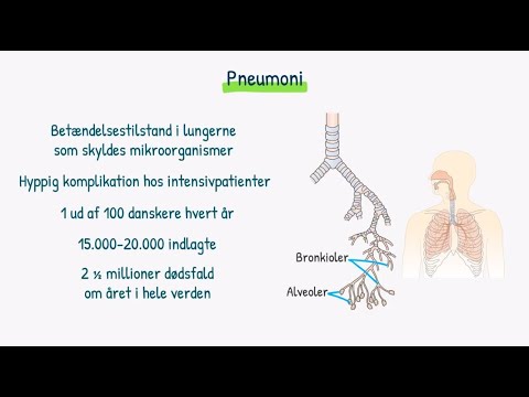 Video: Lungebetændelse - årsager Og Symptomer På Lungebetændelse